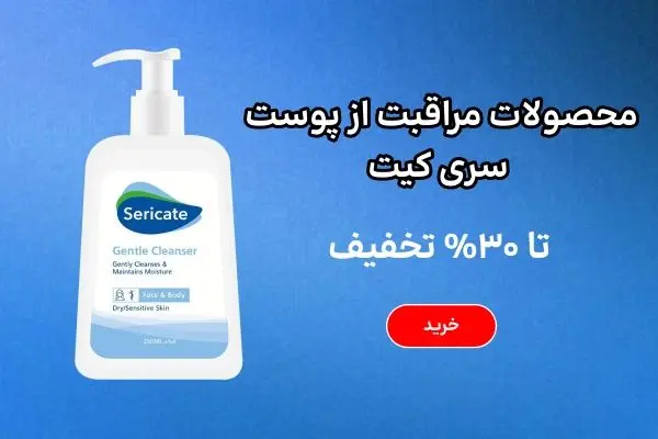 بنر بلاگ سری کیت