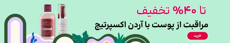 بنر بلاگ آردن اکسپرت ایج