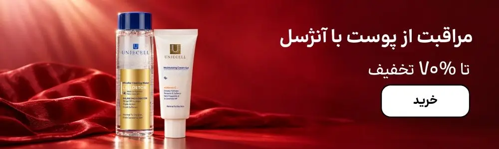 بنر آنژسل (1-5آبان)